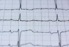 revenue stream for luminary